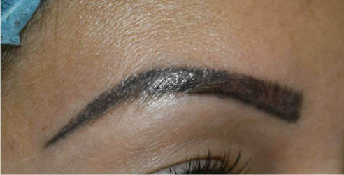 Nouveau Contour - derma innovation - kosmetisk pigmentering- utbildning