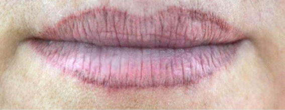 Nouveau Contour - derma innovation - kosmetisk pigmentering- utbildning